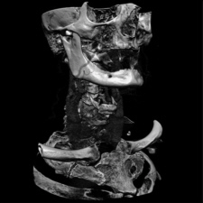 CT-image of a human head